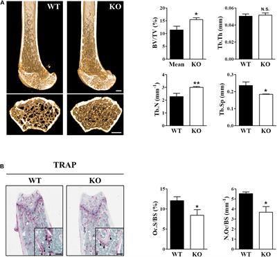 Frontiers Sestrin Regulates Osteoclastogenesis Via The P Traf